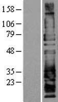 Western blot validation of overexpression lysate (Cat# LY418961) using anti-DDK antibody (Cat# TA50011-100). Left: Cell lysates from un-transfected HEK293T cells; Right: Cell lysates from HEK293T cells transfected with RC206507 using transfection reagent MegaTran 2.0 (Cat# TT210002).