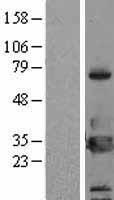 Western blot validation of overexpression lysate (Cat# LY418678) using anti-DDK antibody (Cat# TA50011-100). Left: Cell lysates from un-transfected HEK293T cells; Right: Cell lysates from HEK293T cells transfected with RC200013 using transfection reagent MegaTran 2.0 (Cat# TT210002).