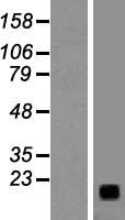 Western blot validation of overexpression lysate (Cat# LY419540) using anti-DDK antibody (Cat# TA50011-100). Left: Cell lysates from un-transfected HEK293T cells; Right: Cell lysates from HEK293T cells transfected with RC202542 using transfection reagent MegaTran 2.0 (Cat# TT210002).