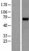 Western blot validation of overexpression lysate (Cat# LY414950) using anti-DDK antibody (Cat# TA50011-100). Left: Cell lysates from un-transfected HEK293T cells; Right: Cell lysates from HEK293T cells transfected with RC207189 using transfection reagent MegaTran 2.0 (Cat# TT210002).