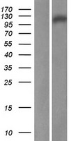 Western blot validation of overexpression lysate (Cat# LY408080) using anti-DDK antibody (Cat# TA50011-100). Left: Cell lysates from un-transfected HEK293T cells; Right: Cell lysates from HEK293T cells transfected with RC206347 using transfection reagent MegaTran 2.0 (Cat# TT210002).