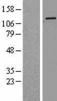 Western blot validation of overexpression lysate (Cat# LY419555) using anti-DDK antibody (Cat# TA50011-100). Left: Cell lysates from un-transfected HEK293T cells; Right: Cell lysates from HEK293T cells transfected with RC206064 using transfection reagent MegaTran 2.0 (Cat# TT210002).
