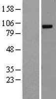 Western blot validation of overexpression lysate (Cat# LY416759) using anti-DDK antibody (Cat# TA50011-100). Left: Cell lysates from un-transfected HEK293T cells; Right: Cell lysates from HEK293T cells transfected with RC216933 using transfection reagent MegaTran 2.0 (Cat# TT210002).