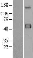 Western blot validation of overexpression lysate (Cat# LY414394) using anti-DDK antibody (Cat# TA50011-100). Left: Cell lysates from un-transfected HEK293T cells; Right: Cell lysates from HEK293T cells transfected with RC201486 using transfection reagent MegaTran 2.0 (Cat# TT210002).