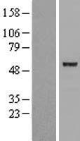 Western blot validation of overexpression lysate (Cat# LY416489) using anti-DDK antibody (Cat# TA50011-100). Left: Cell lysates from un-transfected HEK293T cells; Right: Cell lysates from HEK293T cells transfected with RC205558 using transfection reagent MegaTran 2.0 (Cat# TT210002).