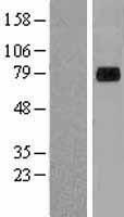Western blot validation of overexpression lysate (Cat# LY418716) using anti-DDK antibody (Cat# TA50011-100). Left: Cell lysates from un-transfected HEK293T cells; Right: Cell lysates from HEK293T cells transfected with RC222768 using transfection reagent MegaTran 2.0 (Cat# TT210002).