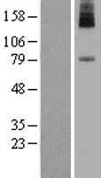 Western blot validation of overexpression lysate (Cat# LY415771) using anti-DDK antibody (Cat# TA50011-100). Left: Cell lysates from un-transfected HEK293T cells; Right: Cell lysates from HEK293T cells transfected with RC222950 using transfection reagent MegaTran 2.0 (Cat# TT210002).