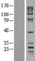 Western blot validation of overexpression lysate (Cat# LY414641) using anti-DDK antibody (Cat# TA50011-100). Left: Cell lysates from un-transfected HEK293T cells; Right: Cell lysates from HEK293T cells transfected with RC206808 using transfection reagent MegaTran 2.0 (Cat# TT210002).