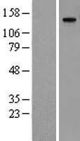 Western blot validation of overexpression lysate (Cat# LY416024) using anti-DDK antibody (Cat# TA50011-100). Left: Cell lysates from un-transfected HEK293T cells; Right: Cell lysates from HEK293T cells transfected with RC209545 using transfection reagent MegaTran 2.0 (Cat# TT210002).