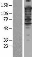 Western blot validation of overexpression lysate (Cat# LY408410) using anti-DDK antibody (Cat# TA50011-100). Left: Cell lysates from un-transfected HEK293T cells; Right: Cell lysates from HEK293T cells transfected with RC203774 using transfection reagent MegaTran 2.0 (Cat# TT210002).