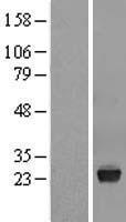 Western blot validation of overexpression lysate (Cat# LY409151) using anti-DDK antibody (Cat# TA50011-100). Left: Cell lysates from un-transfected HEK293T cells; Right: Cell lysates from HEK293T cells transfected with RC207656 using transfection reagent MegaTran 2.0 (Cat# TT210002).