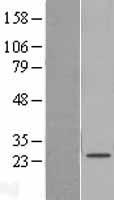 Western blot validation of overexpression lysate (Cat# LY404050) using anti-DDK antibody (Cat# TA50011-100). Left: Cell lysates from un-transfected HEK293T cells; Right: Cell lysates from HEK293T cells transfected with RC224467 using transfection reagent MegaTran 2.0 (Cat# TT210002).