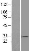 Western blot validation of overexpression lysate (Cat# LY404275) using anti-DDK antibody (Cat# TA50011-100). Left: Cell lysates from un-transfected HEK293T cells; Right: Cell lysates from HEK293T cells transfected with RC209415 using transfection reagent MegaTran 2.0 (Cat# TT210002).