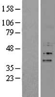 Western blot validation of overexpression lysate (Cat# LY407354) using anti-DDK antibody (Cat# TA50011-100). Left: Cell lysates from un-transfected HEK293T cells; Right: Cell lysates from HEK293T cells transfected with RC206934 using transfection reagent MegaTran 2.0 (Cat# TT210002).