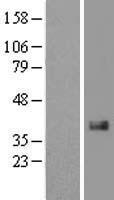 Western blot validation of overexpression lysate (Cat# LY419668) using anti-DDK antibody (Cat# TA50011-100). Left: Cell lysates from un-transfected HEK293T cells; Right: Cell lysates from HEK293T cells transfected with RC210336 using transfection reagent MegaTran 2.0 (Cat# TT210002).