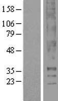 Western blot validation of overexpression lysate (Cat# LY420740) using anti-DDK antibody (Cat# TA50011-100). Left: Cell lysates from un-transfected HEK293T cells; Right: Cell lysates from HEK293T cells transfected with RC218915 using transfection reagent MegaTran 2.0 (Cat# TT210002).