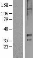 Western blot validation of overexpression lysate (Cat# LY424479) using anti-DDK antibody (Cat# TA50011-100). Left: Cell lysates from un-transfected HEK293T cells; Right: Cell lysates from HEK293T cells transfected with RC210240 using transfection reagent MegaTran 2.0 (Cat# TT210002).