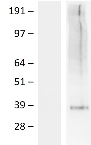 Western blot validation of overexpression lysate (Cat# LY424630) using anti-DDK antibody (Cat# TA50011-100). Left: Cell lysates from un-transfected HEK293T cells; Right: Cell lysates from HEK293T cells transfected with RC223291 using transfection reagent MegaTran 2.0 (Cat# TT210002).