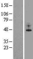 Western blot validation of overexpression lysate (Cat# LY415432) using anti-DDK antibody (Cat# TA50011-100). Left: Cell lysates from un-transfected HEK293T cells; Right: Cell lysates from HEK293T cells transfected with RC210180 using transfection reagent MegaTran 2.0 (Cat# TT210002).
