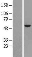 Western blot validation of overexpression lysate (Cat# LY406600) using anti-DDK antibody (Cat# TA50011-100). Left: Cell lysates from un-transfected HEK293T cells; Right: Cell lysates from HEK293T cells transfected with RC210185 using transfection reagent MegaTran 2.0 (Cat# TT210002).