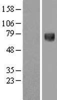 Western blot validation of overexpression lysate (Cat# LY416621) using anti-DDK antibody (Cat# TA50011-100). Left: Cell lysates from un-transfected HEK293T cells; Right: Cell lysates from HEK293T cells transfected with RC209701 using transfection reagent MegaTran 2.0 (Cat# TT210002).