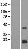 Western blot validation of overexpression lysate (Cat# LY408225) using anti-DDK antibody (Cat# TA50011-100). Left: Cell lysates from un-transfected HEK293T cells; Right: Cell lysates from HEK293T cells transfected with RC205478 using transfection reagent MegaTran 2.0 (Cat# TT210002).