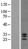 Western blot validation of overexpression lysate (Cat# LY407982) using anti-DDK antibody (Cat# TA50011-100). Left: Cell lysates from un-transfected HEK293T cells; Right: Cell lysates from HEK293T cells transfected with RC205530 using transfection reagent MegaTran 2.0 (Cat# TT210002).