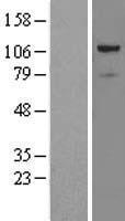 Western blot validation of overexpression lysate (Cat# LY415739) using anti-DDK antibody (Cat# TA50011-100). Left: Cell lysates from un-transfected HEK293T cells; Right: Cell lysates from HEK293T cells transfected with RC200527 using transfection reagent MegaTran 2.0 (Cat# TT210002).