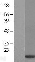 Western blot validation of overexpression lysate (Cat# LY416586) using anti-DDK antibody (Cat# TA50011-100). Left: Cell lysates from un-transfected HEK293T cells; Right: Cell lysates from HEK293T cells transfected with RC201525 using transfection reagent MegaTran 2.0 (Cat# TT210002).
