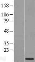 Western blot validation of overexpression lysate (Cat# LY416708) using anti-DDK antibody (Cat# TA50011-100). Left: Cell lysates from un-transfected HEK293T cells; Right: Cell lysates from HEK293T cells transfected with RC201589 using transfection reagent MegaTran 2.0 (Cat# TT210002).