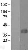 Western blot validation of overexpression lysate (Cat# LY415328) using anti-DDK antibody (Cat# TA50011-100). Left: Cell lysates from un-transfected HEK293T cells; Right: Cell lysates from HEK293T cells transfected with RC201507 using transfection reagent MegaTran 2.0 (Cat# TT210002).