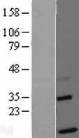 Western blot validation of overexpression lysate (Cat# LY415748) using anti-DDK antibody (Cat# TA50011-100). Left: Cell lysates from un-transfected HEK293T cells; Right: Cell lysates from HEK293T cells transfected with RC202268 using transfection reagent MegaTran 2.0 (Cat# TT210002).