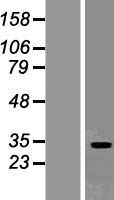 Western blot validation of overexpression lysate (Cat# LY415757) using anti-DDK antibody (Cat# TA50011-100). Left: Cell lysates from un-transfected HEK293T cells; Right: Cell lysates from HEK293T cells transfected with RC201512 using transfection reagent MegaTran 2.0 (Cat# TT210002).