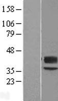 Western blot validation of overexpression lysate (Cat# LY412987) using anti-DDK antibody (Cat# TA50011-100). Left: Cell lysates from un-transfected HEK293T cells; Right: Cell lysates from HEK293T cells transfected with RC222914 using transfection reagent MegaTran 2.0 (Cat# TT210002).