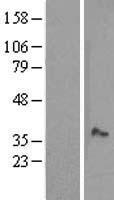 Western blot validation of overexpression lysate (Cat# LY411585) using anti-DDK antibody (Cat# TA50011-100). Left: Cell lysates from un-transfected HEK293T cells; Right: Cell lysates from HEK293T cells transfected with RC203674 using transfection reagent MegaTran 2.0 (Cat# TT210002).
