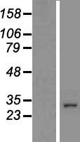 Western blot validation of overexpression lysate (Cat# LY408672) using anti-DDK antibody (Cat# TA50011-100). Left: Cell lysates from un-transfected HEK293T cells; Right: Cell lysates from HEK293T cells transfected with RC202299 using transfection reagent MegaTran 2.0 (Cat# TT210002).