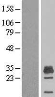 Western blot validation of overexpression lysate (Cat# LY415504) using anti-DDK antibody (Cat# TA50011-100). Left: Cell lysates from un-transfected HEK293T cells; Right: Cell lysates from HEK293T cells transfected with RC202331 using transfection reagent MegaTran 2.0 (Cat# TT210002).