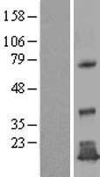 Western blot validation of overexpression lysate (Cat# LY408257) using anti-DDK antibody (Cat# TA50011-100). Left: Cell lysates from un-transfected HEK293T cells; Right: Cell lysates from HEK293T cells transfected with RC203836 using transfection reagent MegaTran 2.0 (Cat# TT210002).