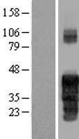 Western blot validation of overexpression lysate (Cat# LY408620) using anti-DDK antibody (Cat# TA50011-100). Left: Cell lysates from un-transfected HEK293T cells; Right: Cell lysates from HEK293T cells transfected with RC203857 using transfection reagent MegaTran 2.0 (Cat# TT210002).