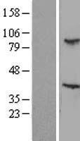 Western blot validation of overexpression lysate (Cat# LY416637) using anti-DDK antibody (Cat# TA50011-100). Left: Cell lysates from un-transfected HEK293T cells; Right: Cell lysates from HEK293T cells transfected with RC203875 using transfection reagent MegaTran 2.0 (Cat# TT210002).