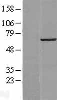 Western blot validation of overexpression lysate (Cat# LY412974) using anti-DDK antibody (Cat# TA50011-100). Left: Cell lysates from un-transfected HEK293T cells; Right: Cell lysates from HEK293T cells transfected with RC203870 using transfection reagent MegaTran 2.0 (Cat# TT210002).