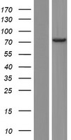 Western blot validation of overexpression lysate (Cat# LY410131) using anti-DDK antibody (Cat# TA50011-100). Left: Cell lysates from un-transfected HEK293T cells; Right: Cell lysates from HEK293T cells transfected with RC202261 using transfection reagent MegaTran 2.0 (Cat# TT210002).