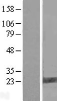 Western blot validation of overexpression lysate (Cat# LY413506) using anti-DDK antibody (Cat# TA50011-100). Left: Cell lysates from un-transfected HEK293T cells; Right: Cell lysates from HEK293T cells transfected with RC201907 using transfection reagent MegaTran 2.0 (Cat# TT210002).