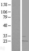 Western blot validation of overexpression lysate (Cat# LY407359) using anti-DDK antibody (Cat# TA50011-100). Left: Cell lysates from un-transfected HEK293T cells; Right: Cell lysates from HEK293T cells transfected with RC202369 using transfection reagent MegaTran 2.0 (Cat# TT210002).