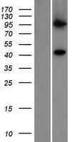 Western blot validation of overexpression lysate (Cat# LY413509) using anti-DDK antibody (Cat# TA50011-100). Left: Cell lysates from un-transfected HEK293T cells; Right: Cell lysates from HEK293T cells transfected with RC201906 using transfection reagent MegaTran 2.0 (Cat# TT210002).