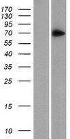 Western blot validation of overexpression lysate (Cat# LY414040) using anti-DDK antibody (Cat# TA50011-100). Left: Cell lysates from un-transfected HEK293T cells; Right: Cell lysates from HEK293T cells transfected with RC202379 using transfection reagent MegaTran 2.0 (Cat# TT210002).