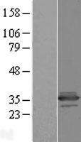 Western blot validation of overexpression lysate (Cat# LY410522) using anti-DDK antibody (Cat# TA50011-100). Left: Cell lysates from un-transfected HEK293T cells; Right: Cell lysates from HEK293T cells transfected with RC204560 using transfection reagent MegaTran 2.0 (Cat# TT210002).