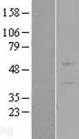 Western blot validation of overexpression lysate (Cat# LY411059) using anti-DDK antibody (Cat# TA50011-100). Left: Cell lysates from un-transfected HEK293T cells; Right: Cell lysates from HEK293T cells transfected with RC204386 using transfection reagent MegaTran 2.0 (Cat# TT210002).