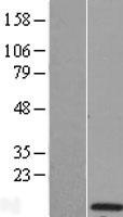Western blot validation of overexpression lysate (Cat# LY405055) using anti-DDK antibody (Cat# TA50011-100). Left: Cell lysates from un-transfected HEK293T cells; Right: Cell lysates from HEK293T cells transfected with RC205394 using transfection reagent MegaTran 2.0 (Cat# TT210002).