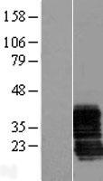 Western blot validation of overexpression lysate (Cat# LY409719) using anti-DDK antibody (Cat# TA50011-100). Left: Cell lysates from un-transfected HEK293T cells; Right: Cell lysates from HEK293T cells transfected with RC205492 using transfection reagent MegaTran 2.0 (Cat# TT210002).